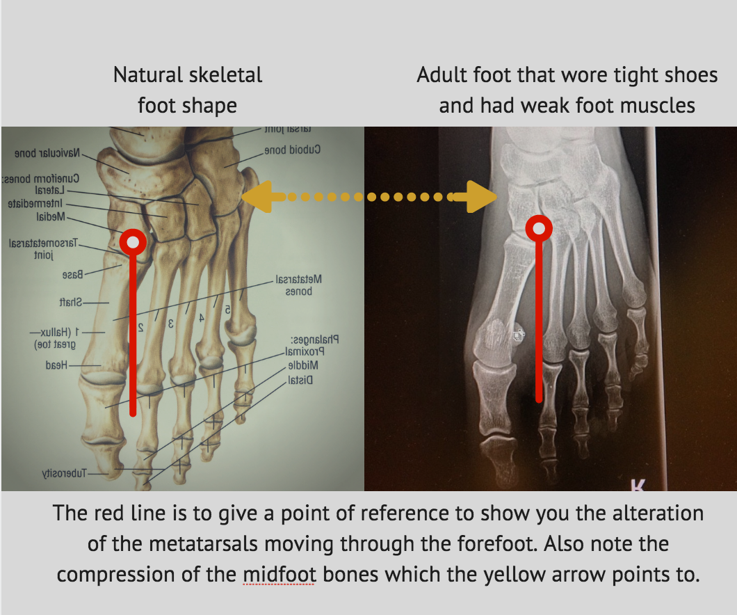 Stop Foot Pain A Nerd’s Guide to Healthy Feet Nerd Fitness